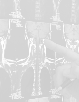 Brain and spinal injuries