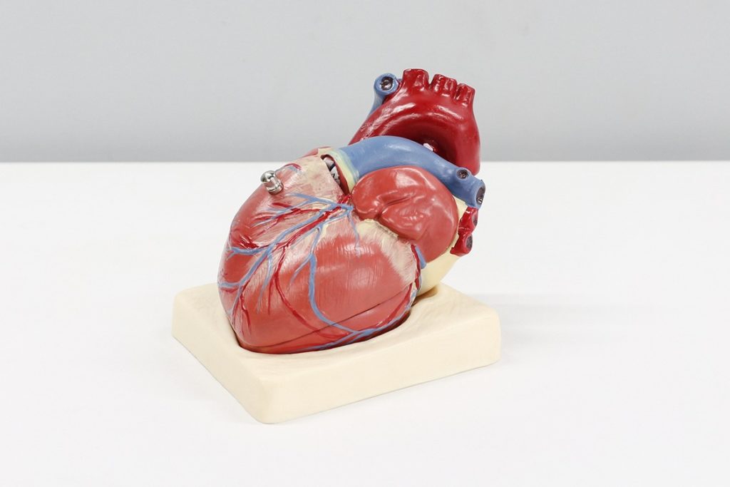 can I recover damages for heart attack 