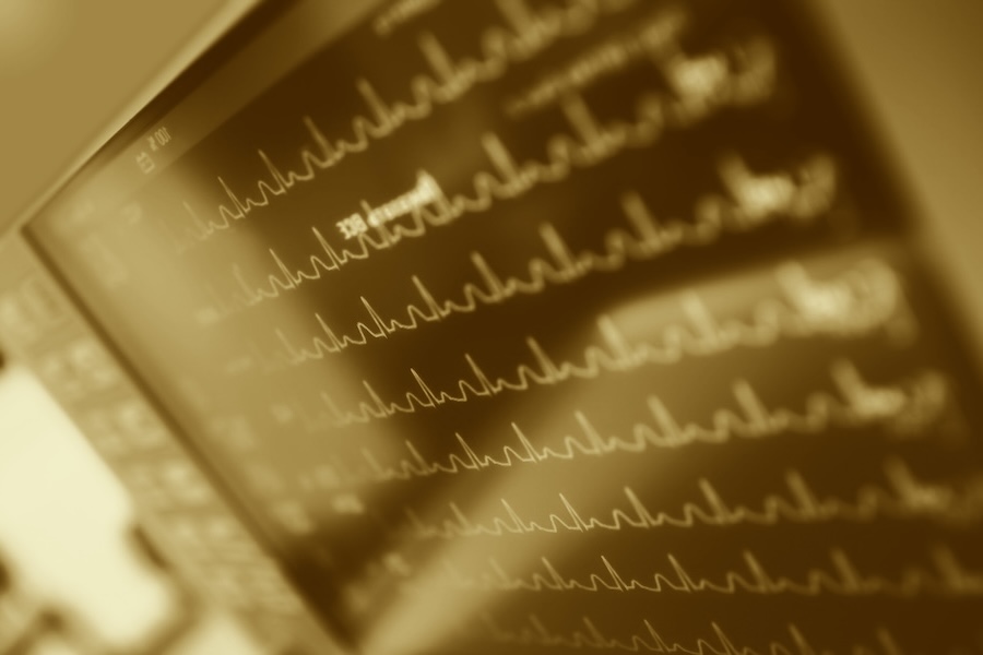 bad outcome or medical malpractice