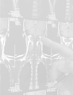 Lesiones cerebrales y de la columna vertebral